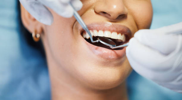 Best Mobile Emergency Dentist in Clarence, IA