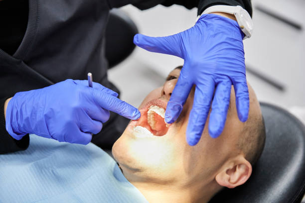 Best Urgent Dental Care for Toothache in Clarence, IA